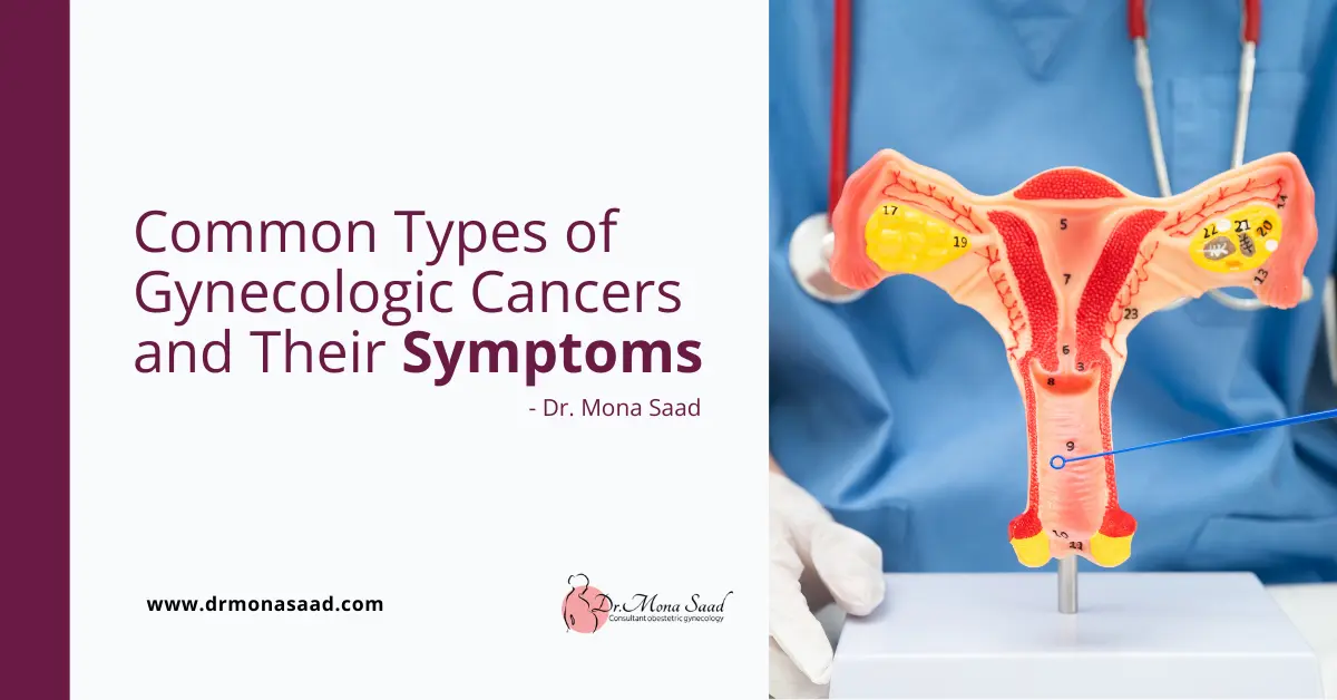 Common Types of Gynecologic Cancers and Their Symptoms